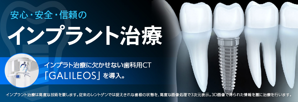 インプラント治療